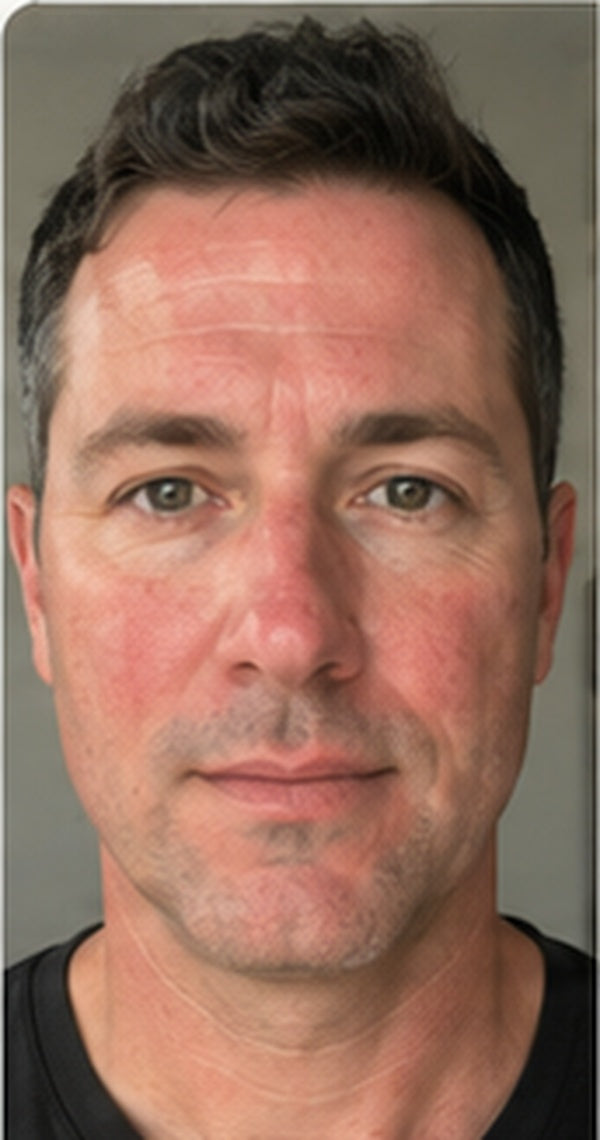 Before image of Lucas, 42